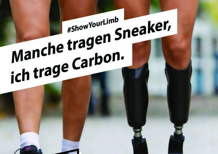Das Poster des BMAB mit dem Logo „Was uns bewegt“ zeigt die Beine von zwei Menschen, die neben einander her gehen: Die Person links trägt kurze Radlerhosen, weiße Socken und Turnschuhe. Die Person rechts trägt ebenfalls kurze Radlerhosen, läuft aber auf sportlichen Prothesen, die unterhalb der Knie ansetzen. Darüber sind der Schriftzug „Manche tragen Sneaker, ich trage Carbon (#ShowYourLimb)“ zu lesen sowie die weiteren Infos zum Aktionstag (Tag der Amputierten, 21. April, www.tag-der-amputierten.de).